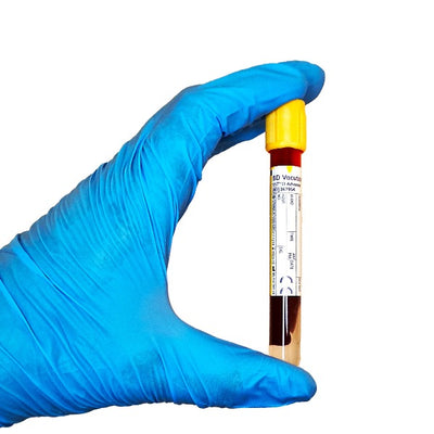 A gloved hand holding a blood tube