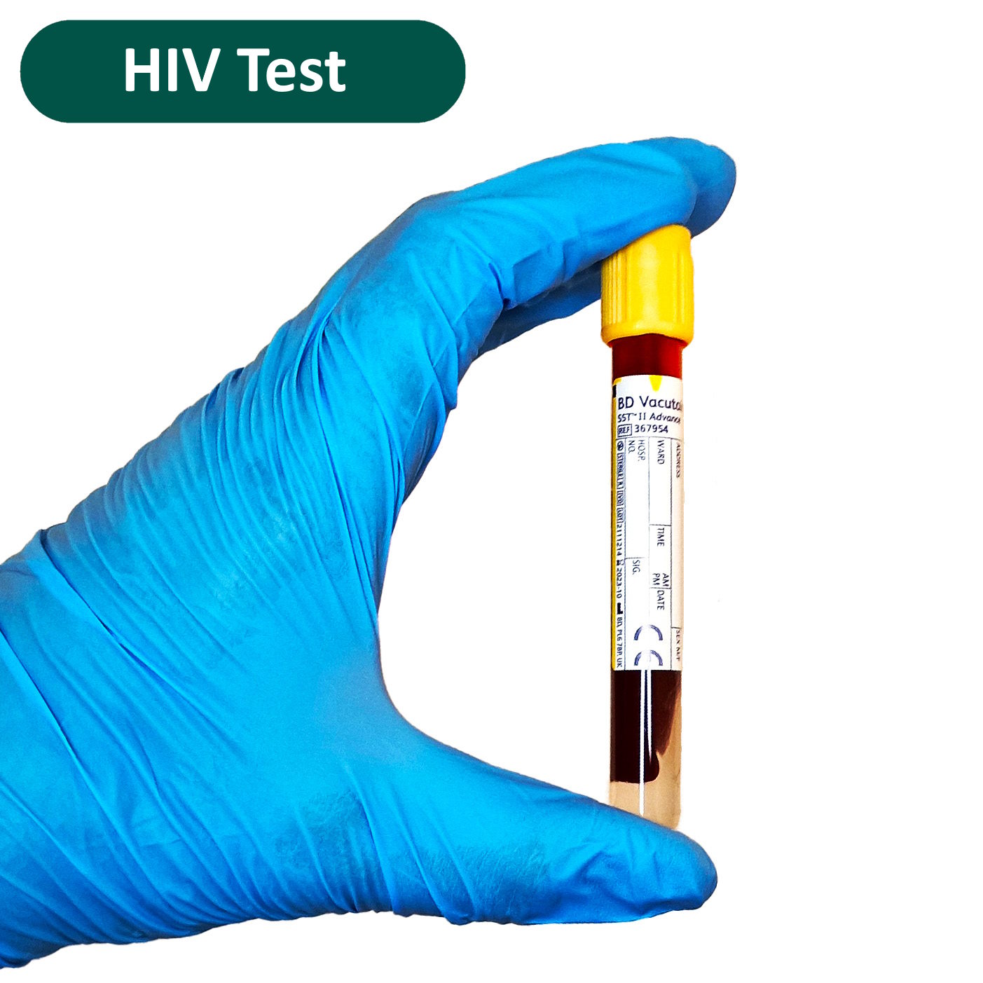HIV Test (4th Generation)