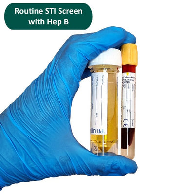 gloved hand holding a urine bottle and blood tube