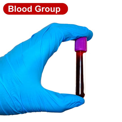 Gloved hand holding a blood tube