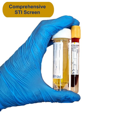 Gloved hand holding urine container and blood tube