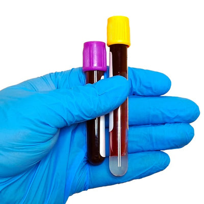 A gloved hand holding 2 blood tubes