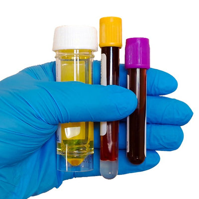A gloved hand holding 2 blood tubes and a urine container