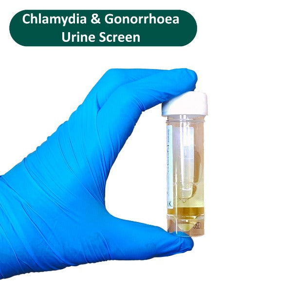Chlamydia & Gonorrhoea Urine Screen | Fast STD Testing