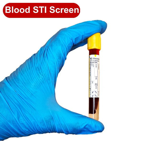 gloved hand holding a blood test tube