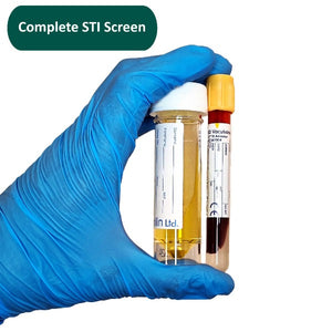 gloved hand holding a urine bottle and blood tube