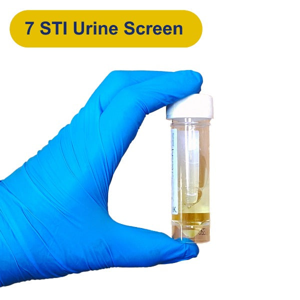 Gloved hand holding urine container