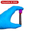 Hepatitis B DNA (Viral load) Blood Test