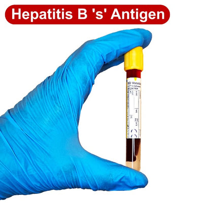 Hepatitis B Surface Antigen Blood Test