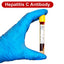 Gloved hand holding a blood tube