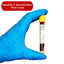 Hepatitis C Quantification (Viral load) Blood Test
