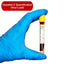 Gloved hand holding a blood tube