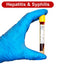 Gloved hand holding a blood tube