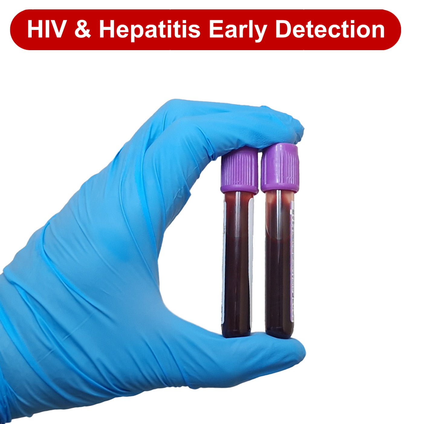 HIV and Hepatitis Early Detection Blood Test