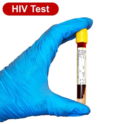 Gloved hand holding a blood tube