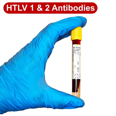 Gloved hand holding a blood tube