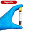 Syphilis Blood Test